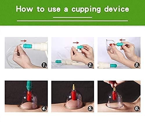 12 Cupping Cups Acupuncture with Extension Tube